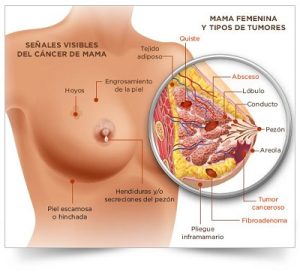 LA PSICOLOGA HELENA BUSTOS NOS CUENTA SU TESTIMONIO DE CANCER DE MAMA Y EL CDS