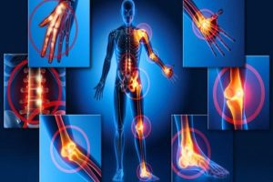 TESTIMONIO FIBROMIALGIA, HERPES, SINUSITIS CURADO CON CDS.