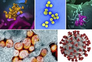 EL TIPICO CASO DE…UN CORONAVIRUS MENOS. EL TIPICO CASO DE…UN CORONAVIRUS MENOS.