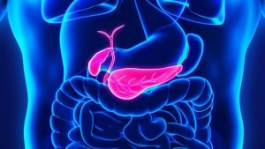 CURACION DE CANCER DE PANCREAS CON CDS ¿ES POSIBLE?