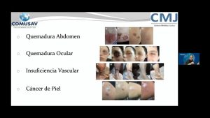 CASOS CLÍNICOS PUBLICADOS EN REVISTAS CIENTÍFICAS TRATADOS CON CDS
