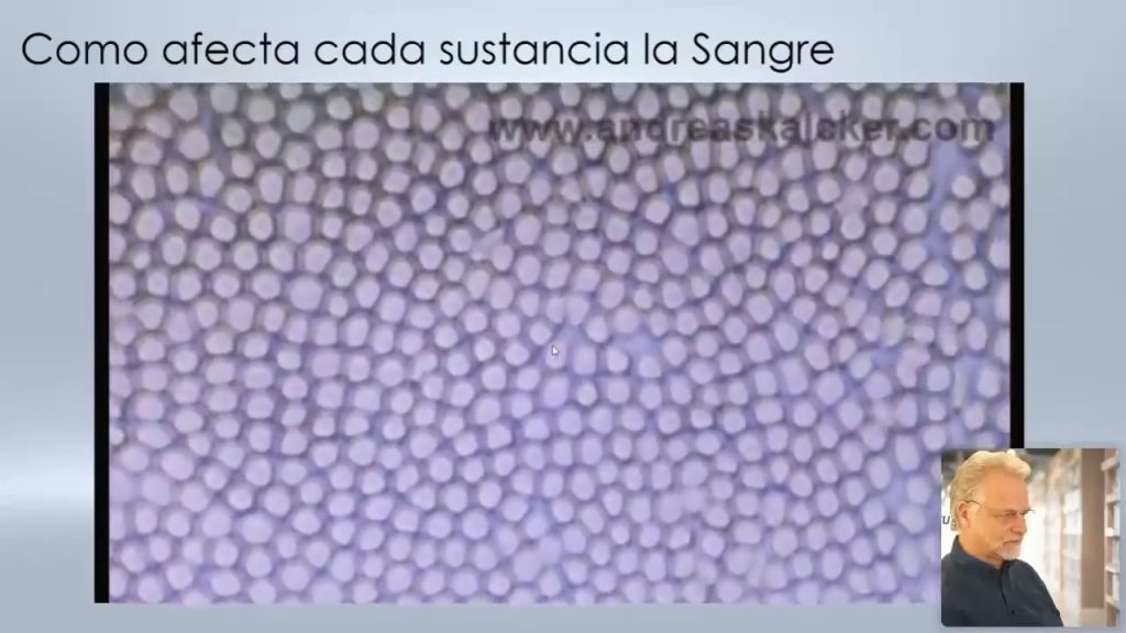 ANDREAS KALCKER  EL CDS EL ANTES Y EL DESPUÉS «PROBABLEMENTE EL MAYOR DESCUBRIMIENTO EN LA MEDICINA DE LOS ULTIMOS 100 AÑOS»