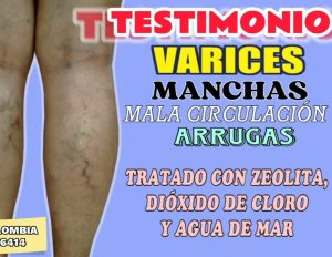 POPURRI DE CASOS CURADOS CON CDS (PARTE 2)