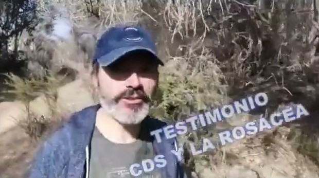 TESTIMONIO. IMPRESIONANTE EL CDS Y LA ROSACEA