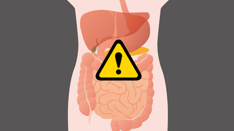 POR DR CHAVEZ, CANCER DE COLON CURADO CON CDS
