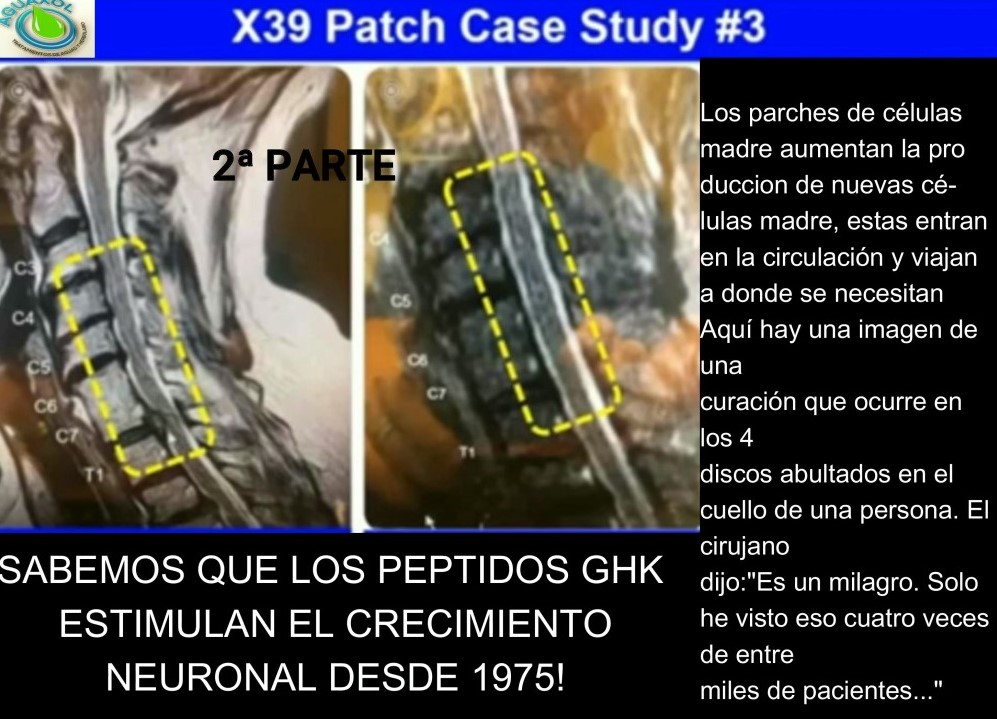 LA CIENCIA EN LOS PARCHES DE LIFEWAVE POR EL Dr Andrew Rostenberg (2ª Parte )