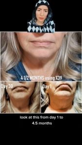 POPURRI DE CASOS DE REJUVENECER EL ANTES Y EL DESPUES CON LIFEWAVE